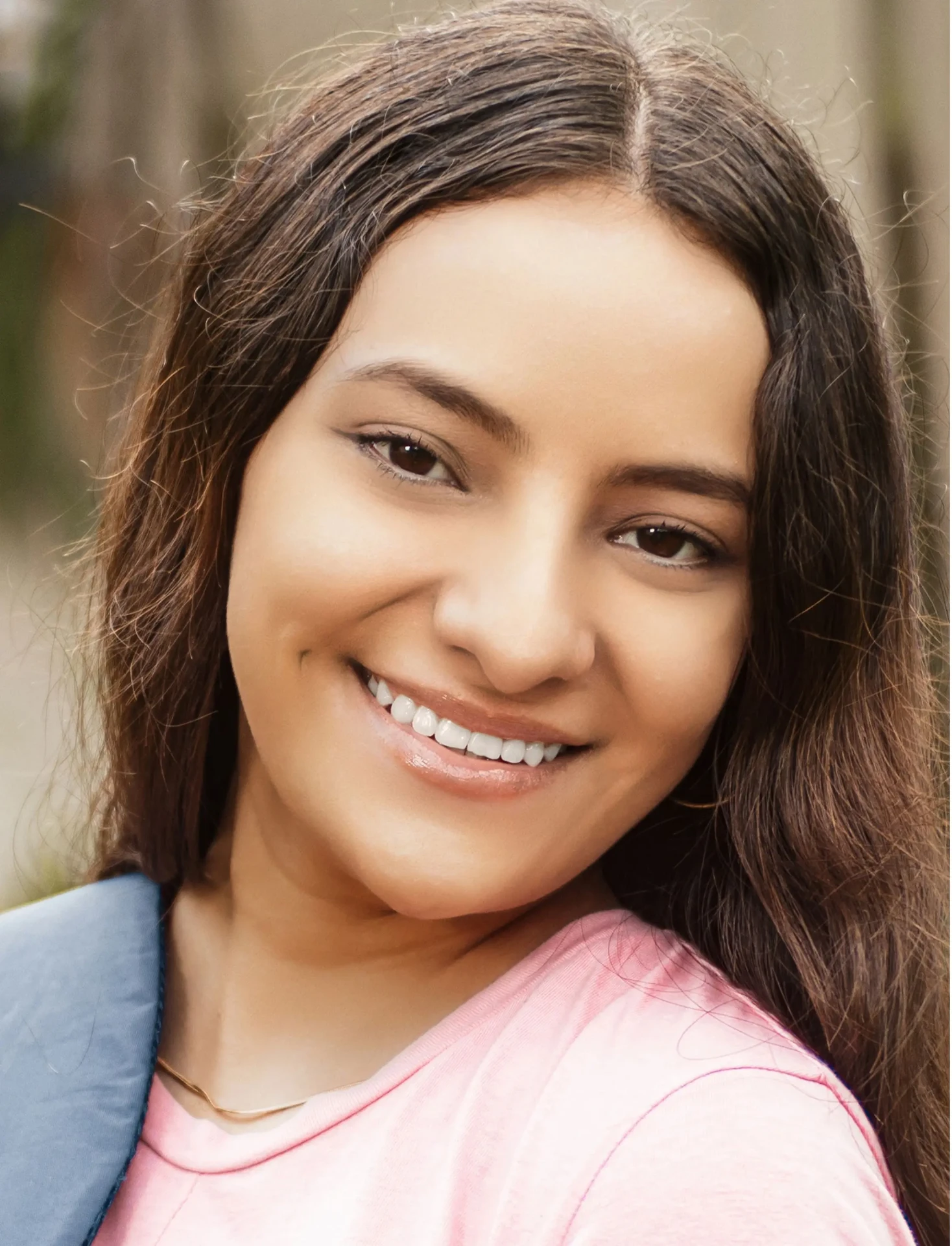 After Orthodontics Mississauga - Teen braces transformation